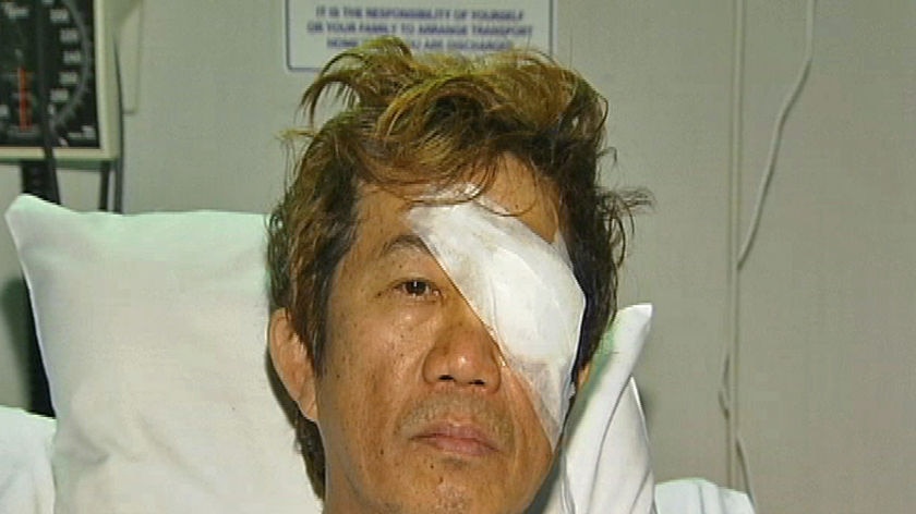 Perth bus driver Gerard Sin  had surgery to remove an eye after being attacked on the job last week