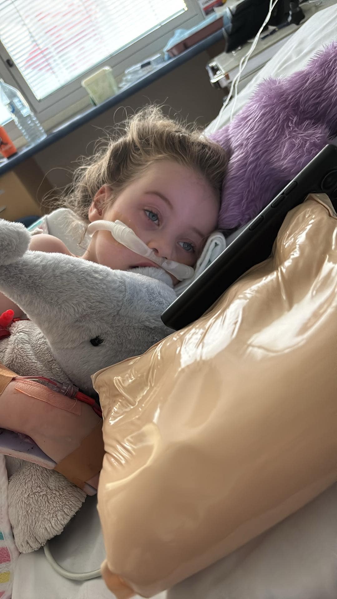 A young girl lying on a bed with a nasal canula placed 