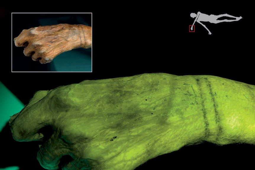 A mummified hand with two tattooed lines on the wrist, with an inset diagram showing a human figure.