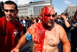 A man covered in his own blood escapes a protest in Athens