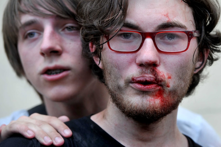 Gay rights activist is injured in Russia