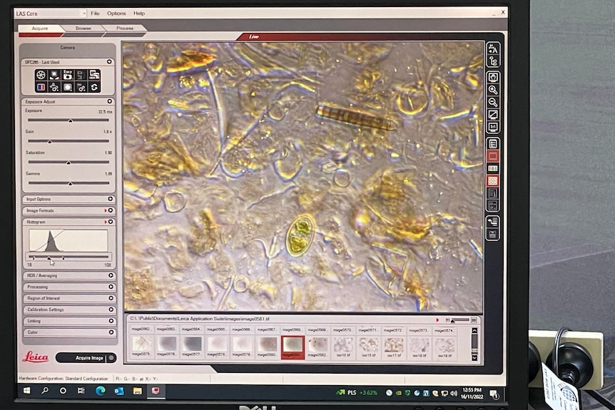Photo of a screen displaying a microscope sample 