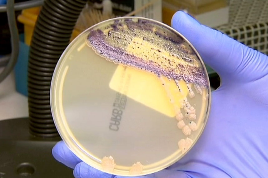 KPC bacteria in petrie dish
