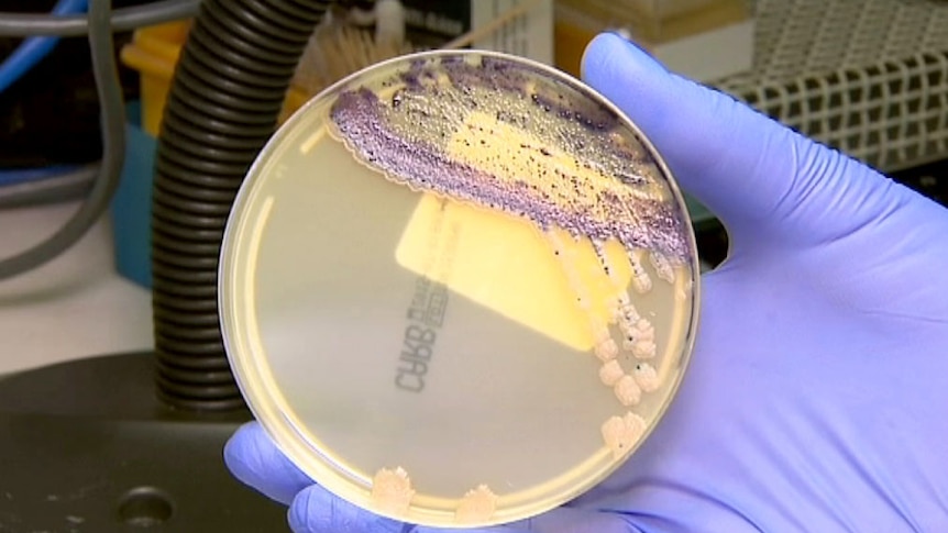 KPC bacteria in petrie dish