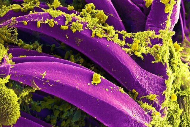 Scanning electron micrograph of Yersinia pestis
