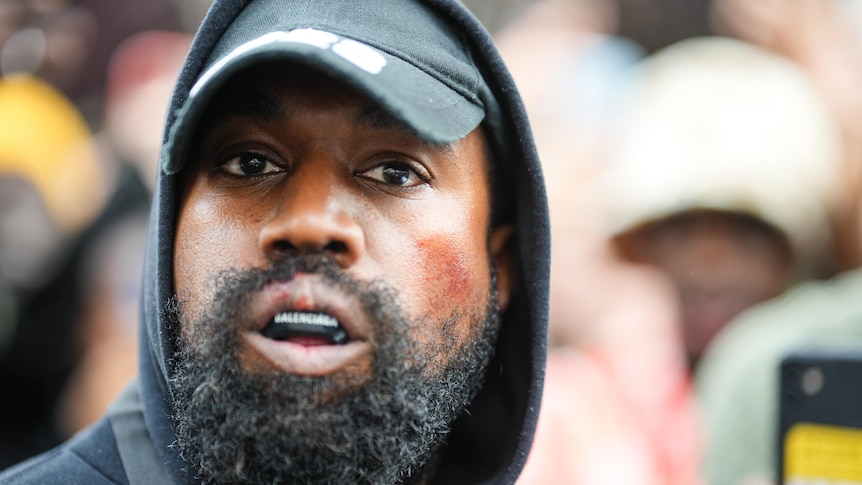 A bearded Kanye West looks at camera wearing a dark hooded top and hat and with a boxing mouthpiece in place
