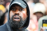 A bearded Kanye West looks at camera wearing a dark hooded top and hat and with a boxing mouthpiece in place