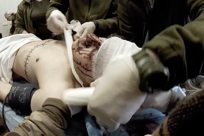 Ukrainian soldier with a blood-covered face has his head bandaged up by multiple pairs of hands in a hospital. 