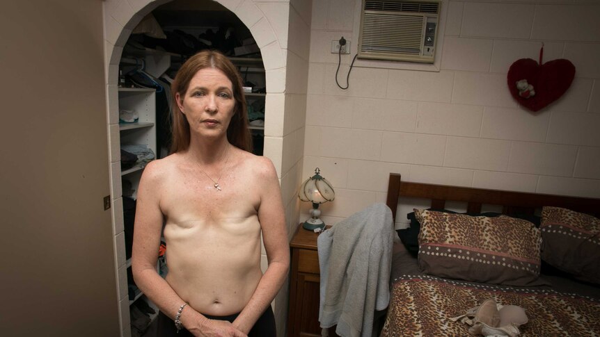 Topless photo of Jeanne Christie looking at the camera after her double mastectomy
