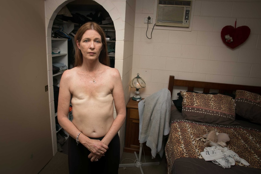 Topless photo of Jeanne Christie looking at the camera after her double mastectomy