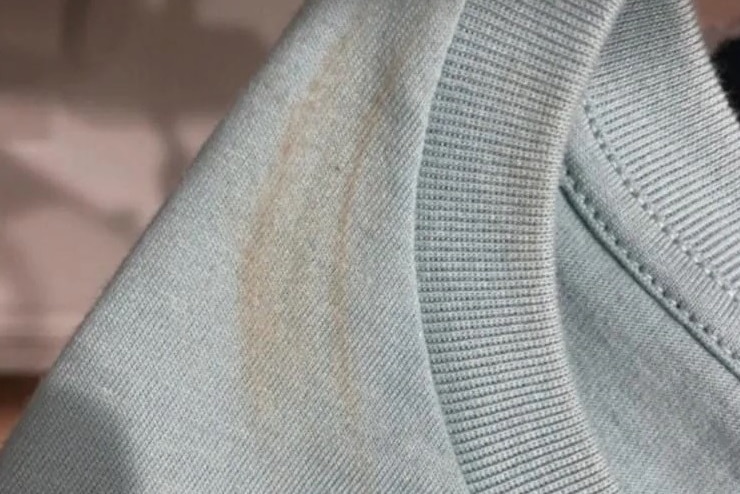 An image posted on Chinese social media shows a brown mark across the collar of a light grey top.