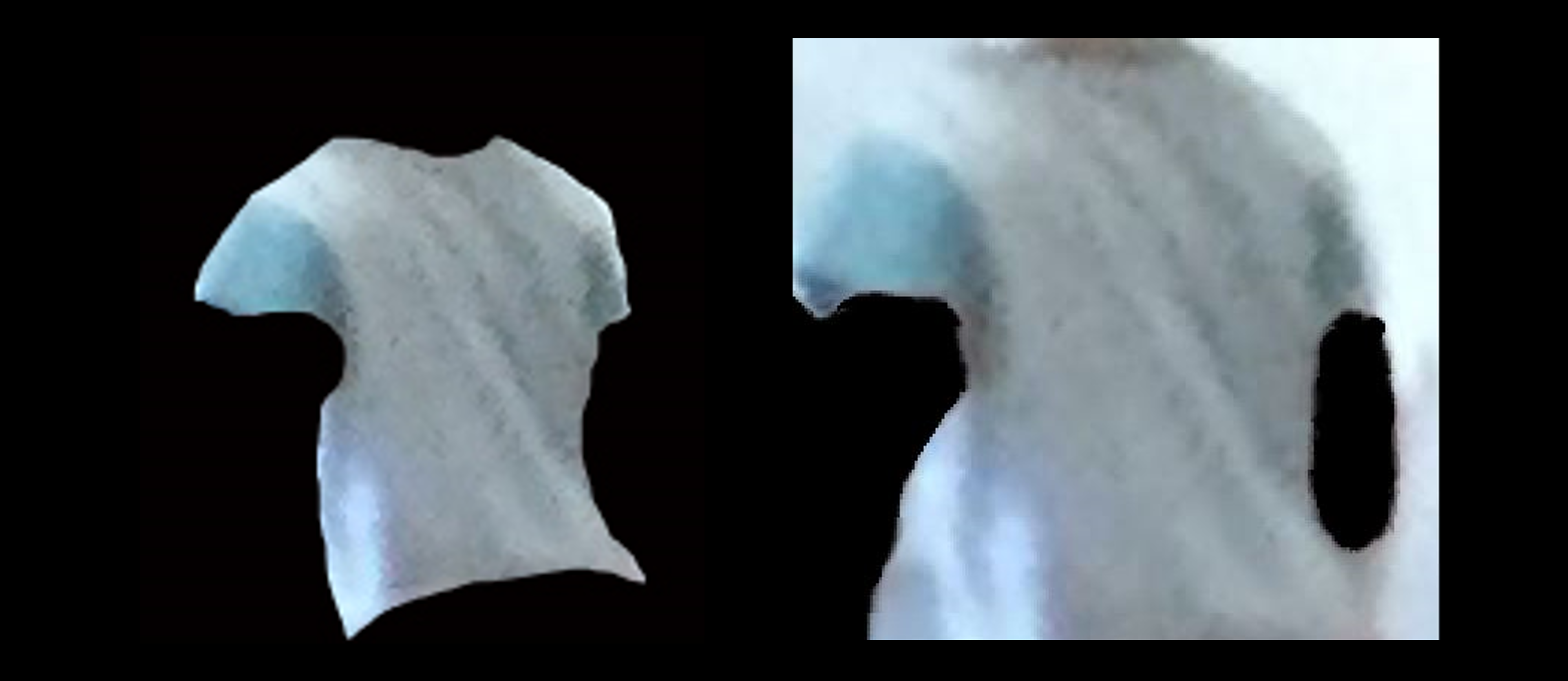 De-identified images of a child wearing a light-coloured t-shirt.