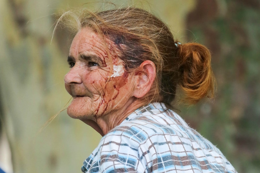 A woman with blood on her face.