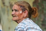 A woman with blood on her face.