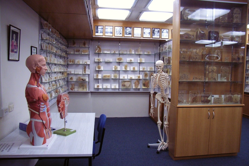 Slices of body parts covered in Perspex and put on display on walls.