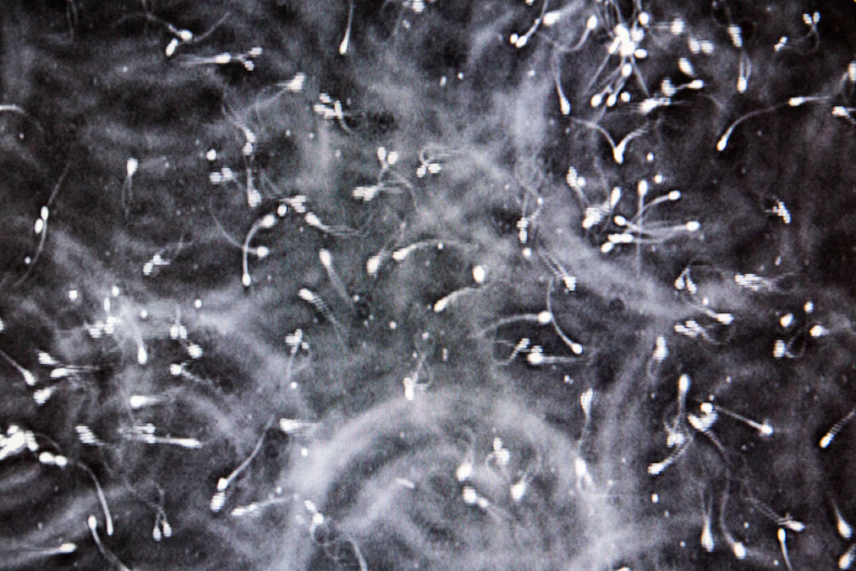 Scientists develop new method for keeping horse sperm alive for longer