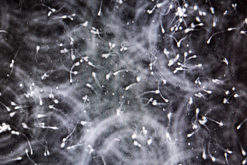 Horse sperm appear on a computer screen.