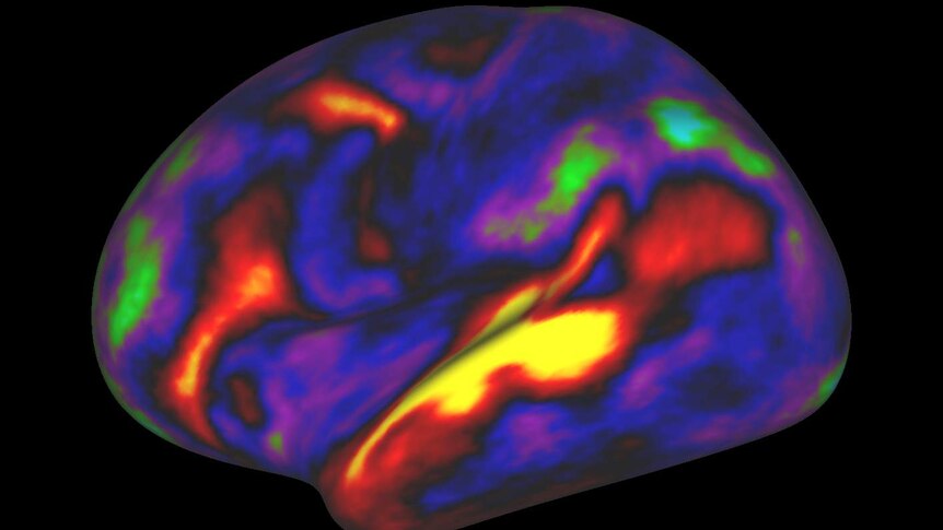 Human cortical parcellation on the right and left hemisphere