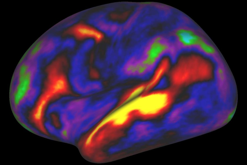 Human cortical parcellation on the right and left hemisphere