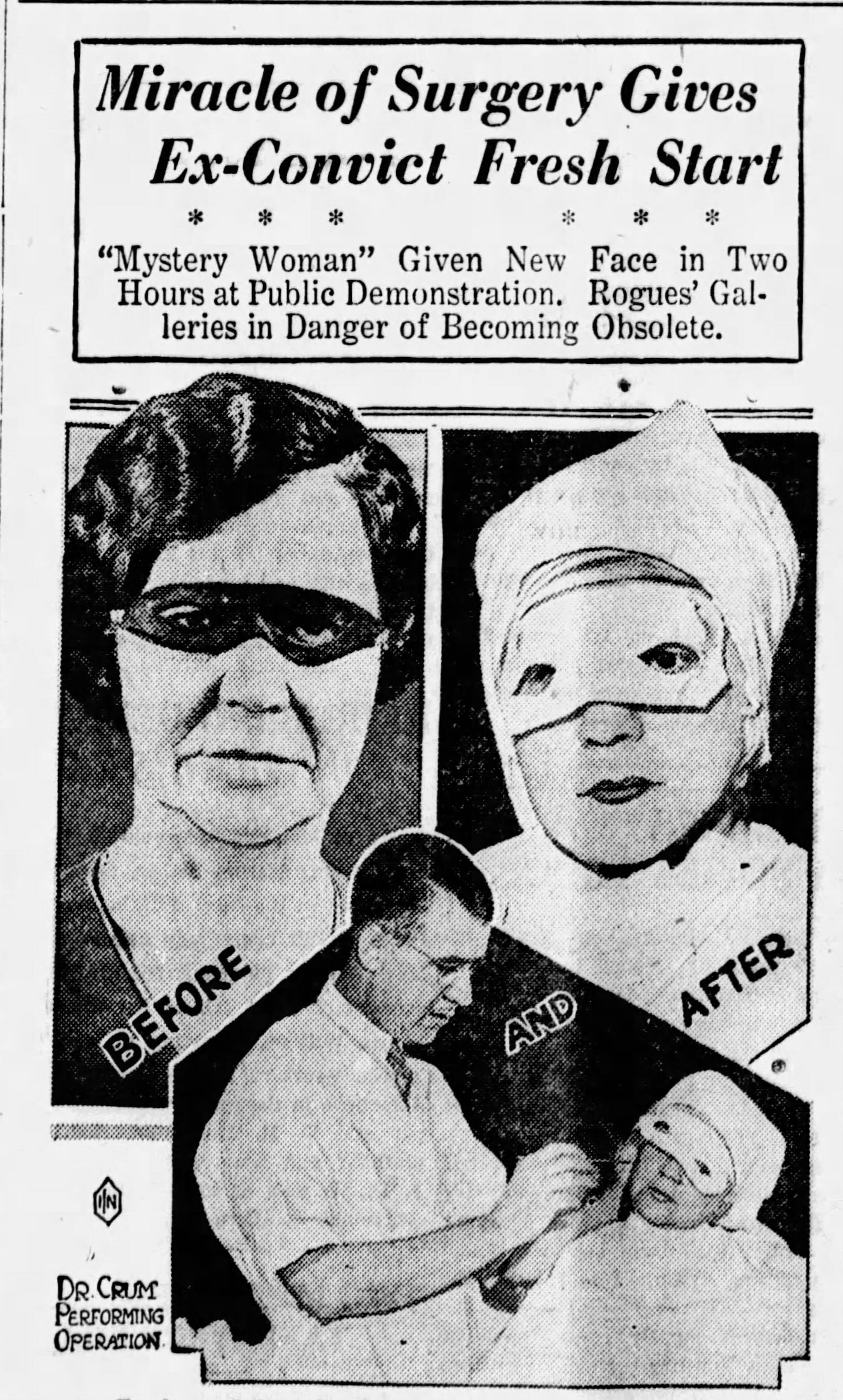 Newspaper clipping with headline 'Miracle of surgery gives ex-convict fresh start' and image of woman with eye mask.