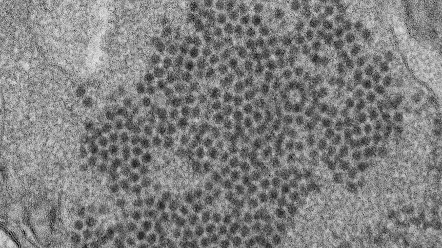 Microscope shows spheroid-shaped Enterovirus-D68 in black and white