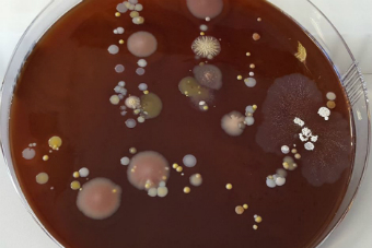 Bacteria in a petrie dish.
