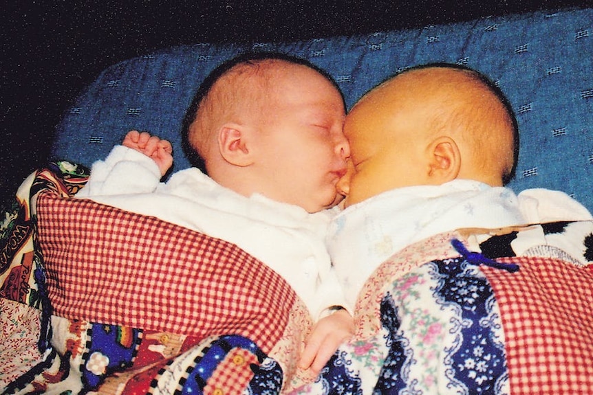 两个婴儿，右边一个的皮肤由于黄疸病而呈现淡淡的橘黄色