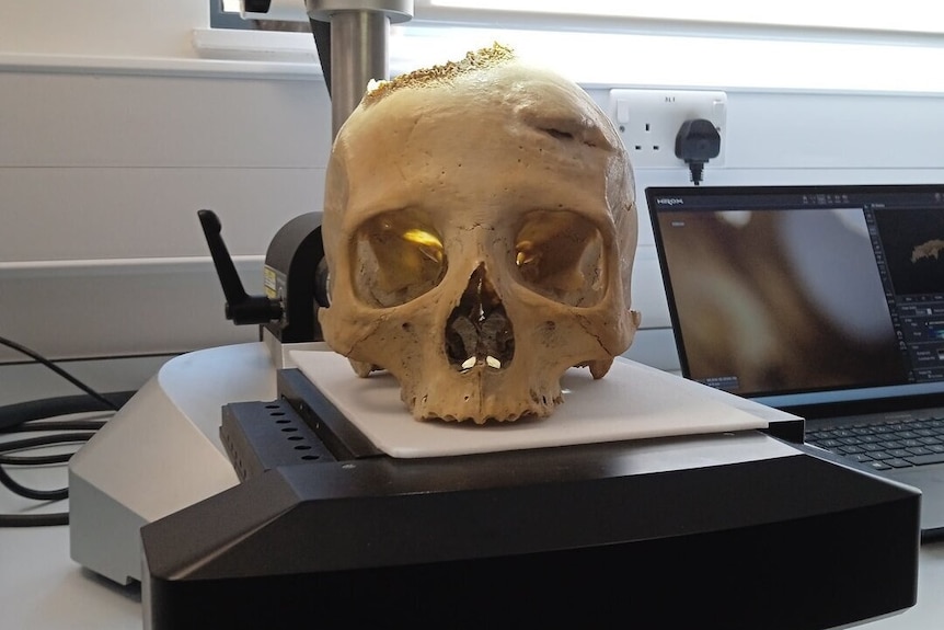 A skull sitting under a microscope