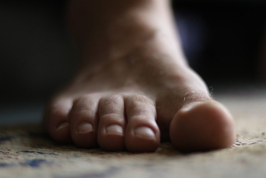 A close up photo of a foot with hairy toes
