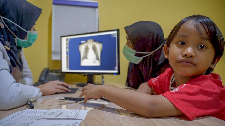 A little Indonesian boy gazes at the camera while two women examine a lung x-ray
