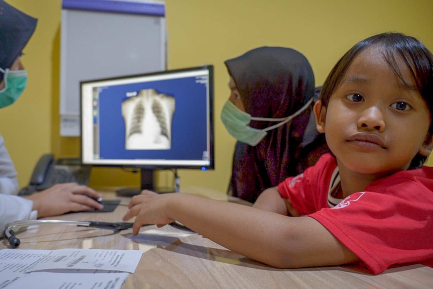 A little Indonesian boy gazes at the camera while two women examine a lung x-ray