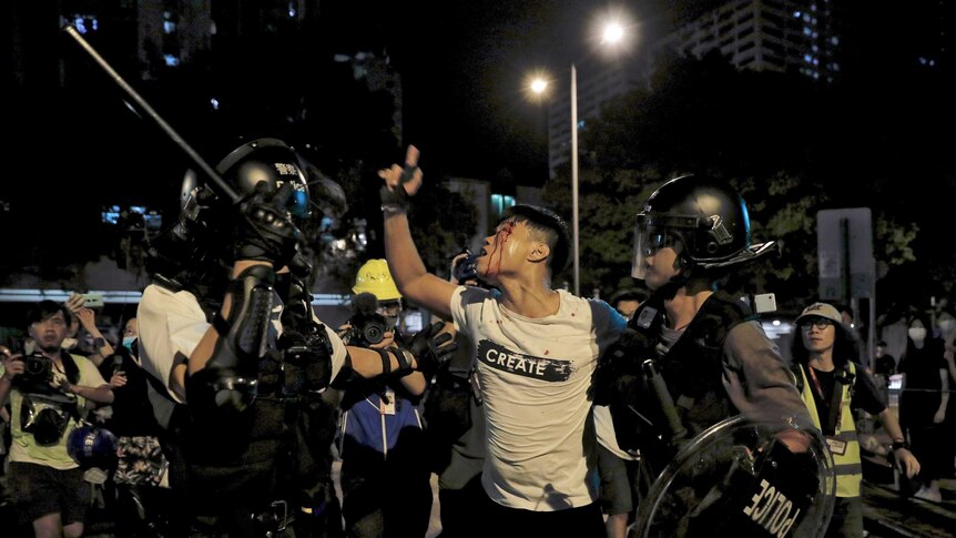 A bleeding man reacts as he is taken away by policemen in Hong Kong.