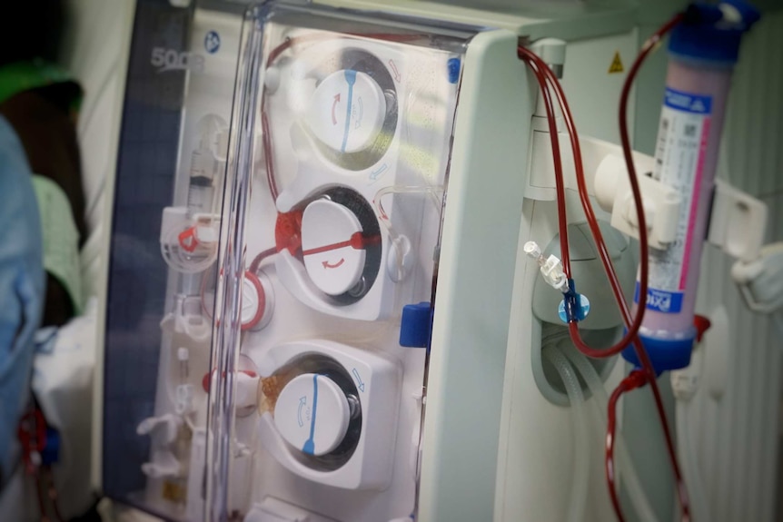 Close up of a dialysis machine