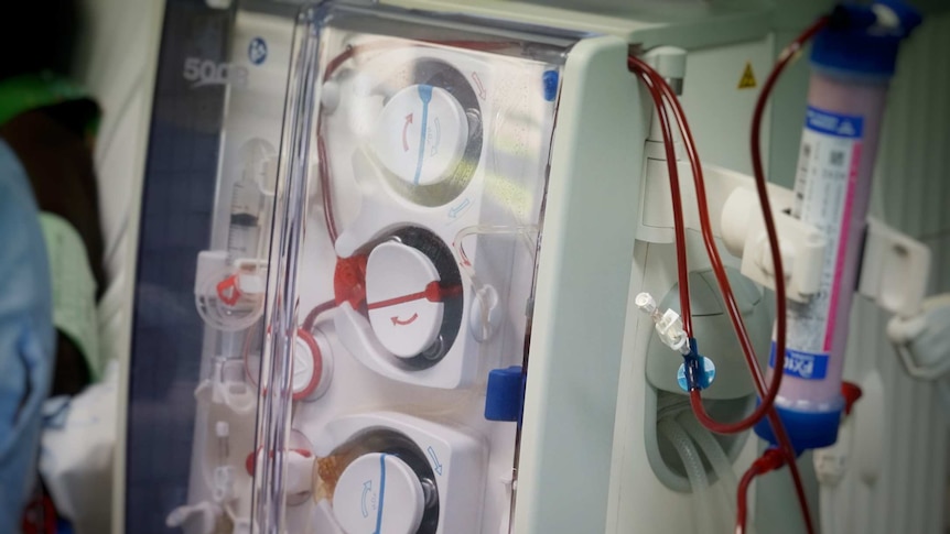 Close up of a dialysis machine