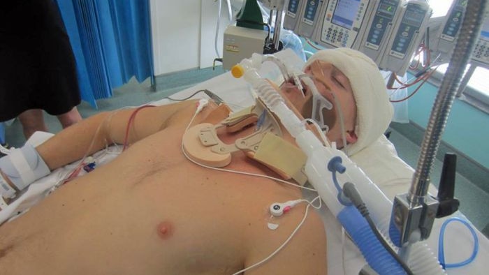 Michael McEwan was in an induced coma after he was bashed in Bondi in December 2013.