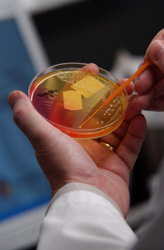 Co-infections: How pathogens work together in the human body