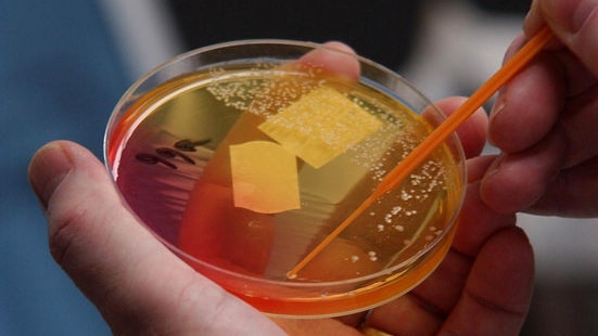 Agar plate containing a staph colony