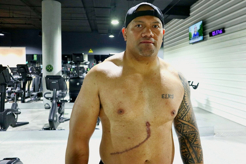 A shirtless muscly Tongan man with a scar on his stomach and wearing his cap backwards standing in a gym.
