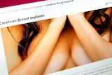 Cereform breast implants
