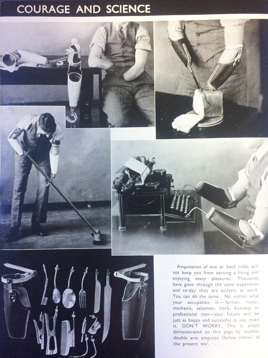 1945 amputees manual demonstrates prosthetic technology available to World War II veterans