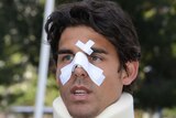 Tennis player Thomas Drouet, hitting partner of Bernard Tomic, with facial injuries, May 6 2013