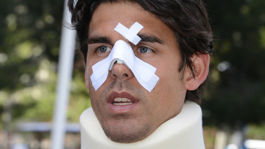 Tennis player Thomas Drouet, hitting partner of Bernard Tomic, with facial injuries, May 6 2013