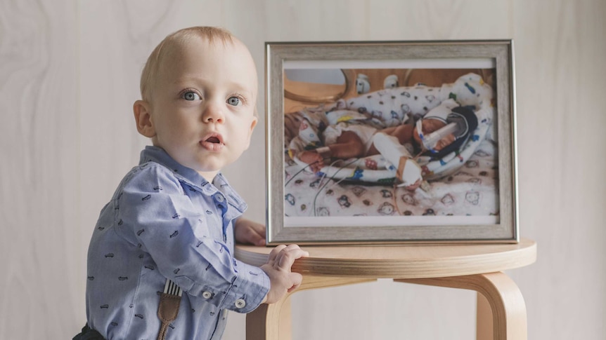 18 month old Jordan Watson who born 9 weeks premature looks at a picture of himself at birth