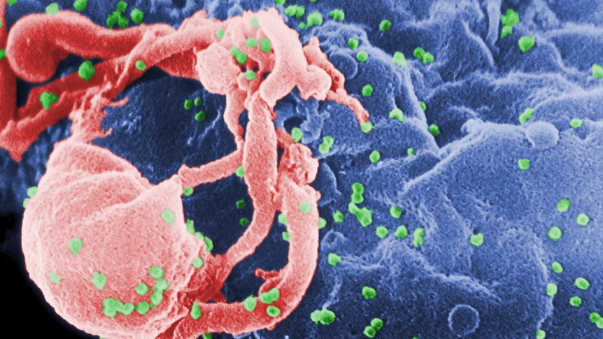 HIV budding from lymphocyte