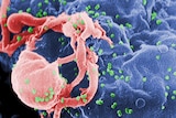 HIV budding from lymphocyte