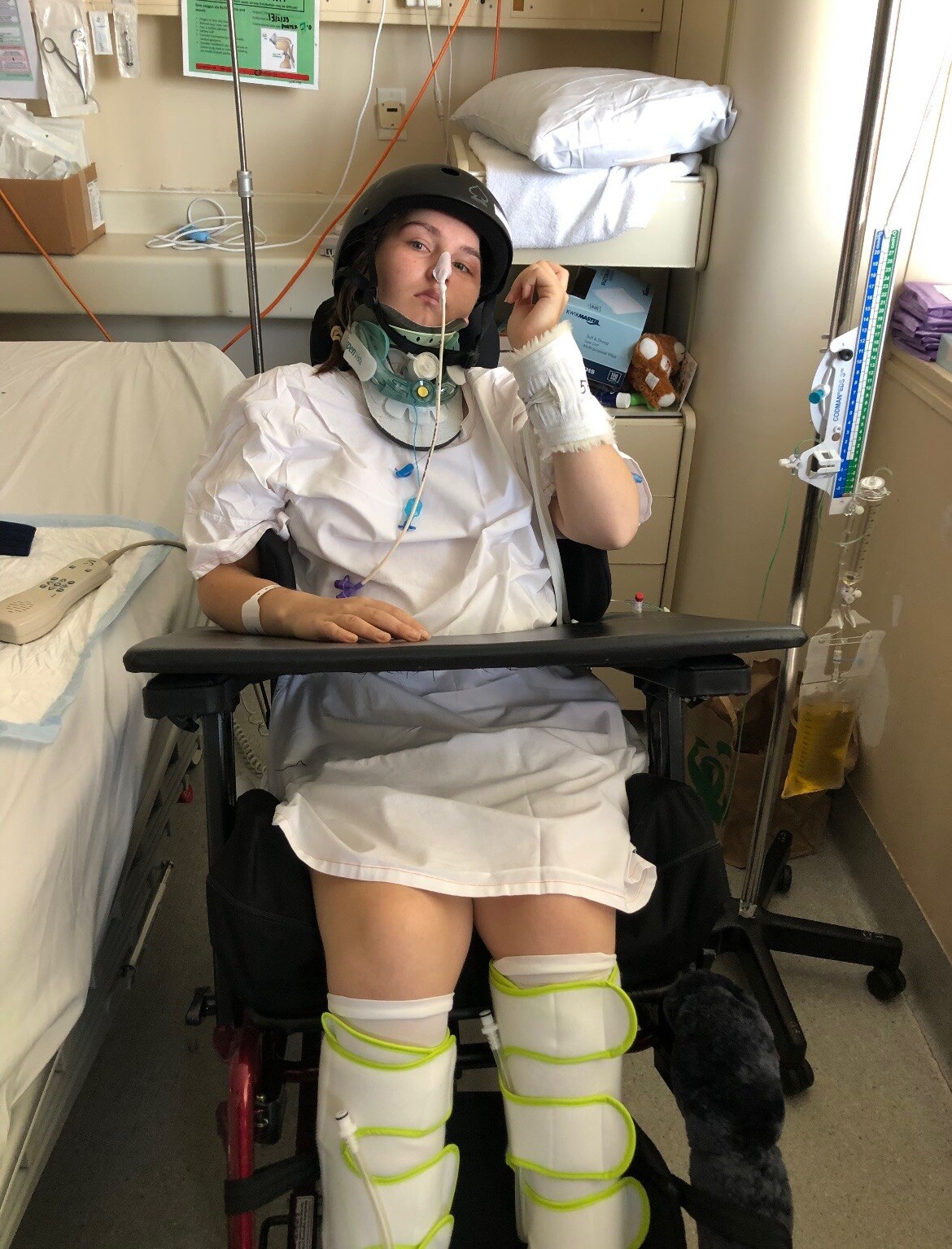 A young woman sits in hospital after suffering a skull fracture.