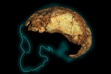 Homo erectus skull bones on outline of what skull would have looked like.