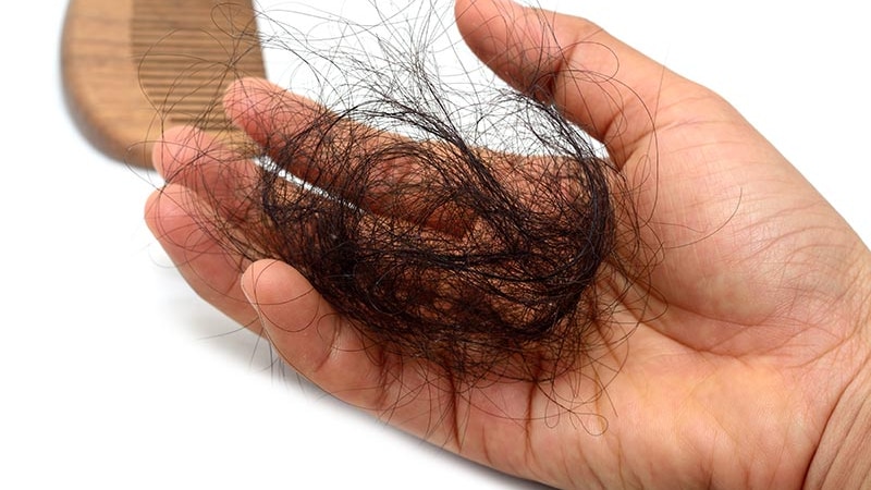 Hair pulled out of hair comb