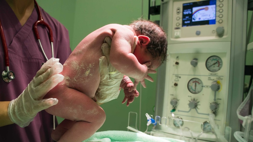 a person (obviously in hospital) holds a very new born baby up against monitors