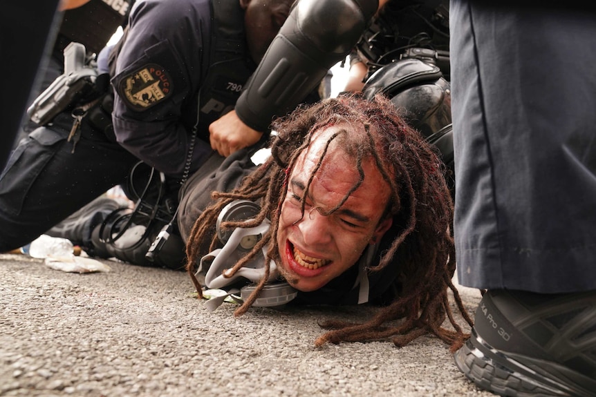 A man winces as he lays on the ground, held down by police.